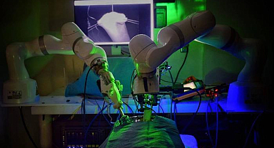 Teknoloji facia getirdi: Ameliyat robotu hastayı öldürdü... Skandal iddialar!