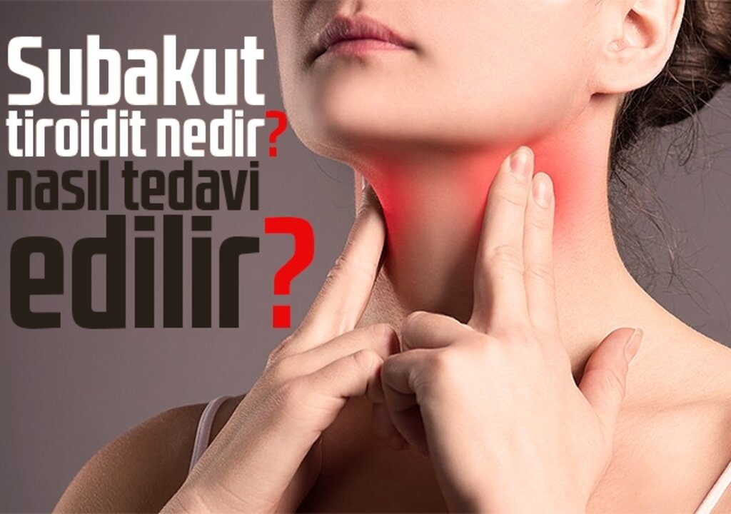 Subakut tiroidit nedir, nasıl tedavi edilir?